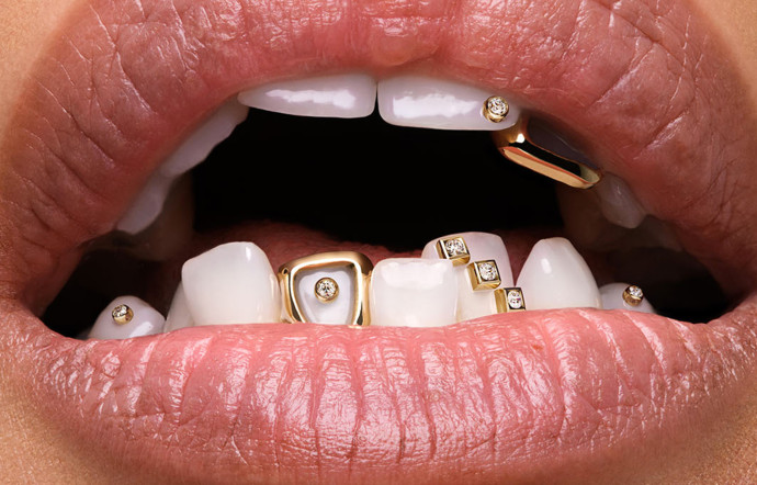 Avec ses grillz, Dolly Cohen est la nouvelle star de la joaillerie française.